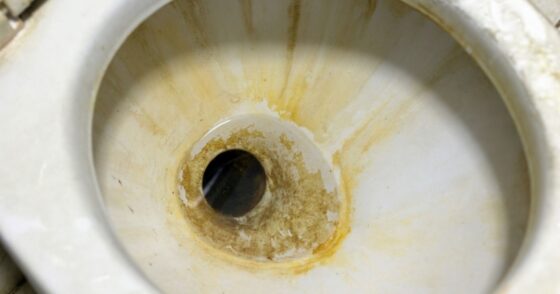 6 astuces naturelles pour redonner leur blancheur à des toilettes jaunies 27 Normal 2025 10 07T070500.286 560x294 1