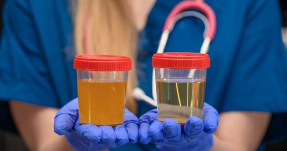 Normal 2026 02 03T071422.874 560x294 1